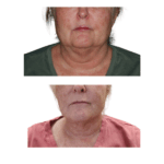 Before and After Agnes