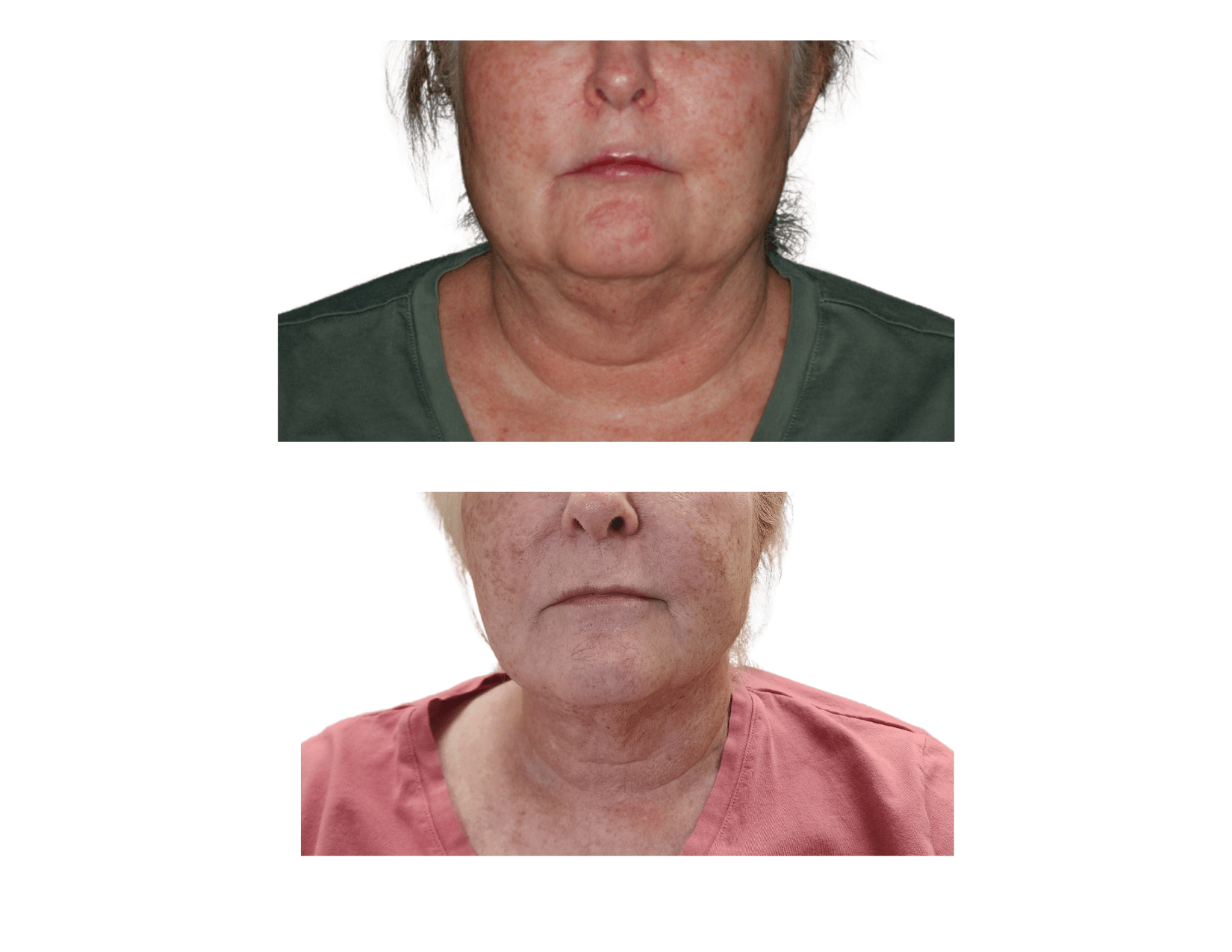 Before and After Agnes